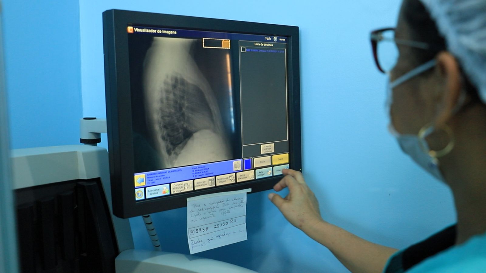 Tuberculose é uma doença infecciosa e contagiosa, causada pela bactéria Mycobacterium tuberculosis